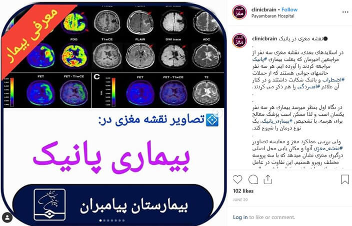 پست اینستاگرام تصاویر نقشه مغزی در بیماری پانیک