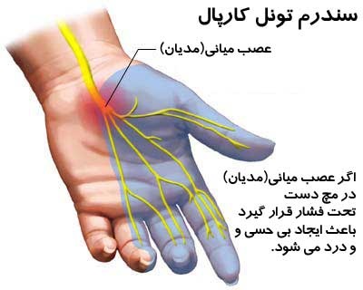 سندرم تونل کارپ: اینستاگرام