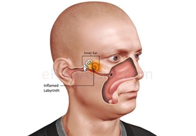 لابیرنت گوش چیست؟【دلایل اختلال در تعادل】سرگیجه ناشی از گوش میانی
