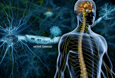 سوالات رایج درباره بیماری ام اس