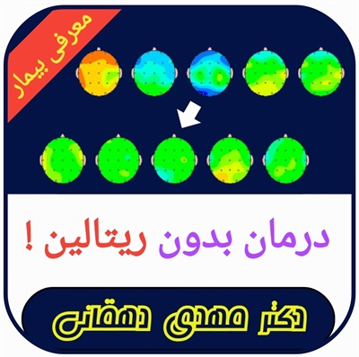 🔴 درمان بدون ریتالین!