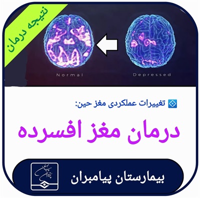 🔴 درمان مغز افسرده!