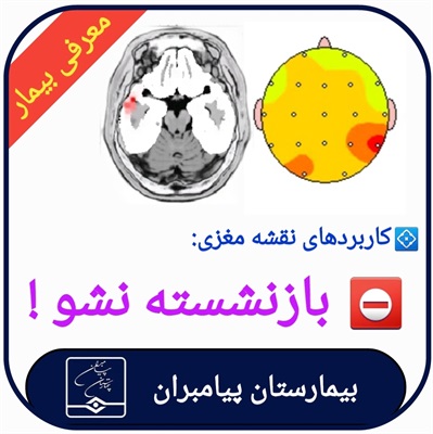 🔴 بازنشسته نشو!