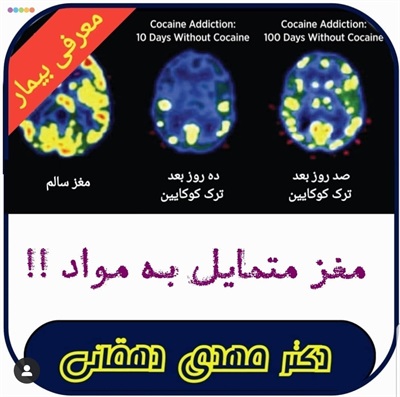 🔴 مغز متمایل به مواد!!