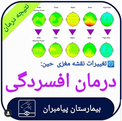 درمان افسردگی با نوروتراپی【بیمار واقعی که درمان شد】مغزمن