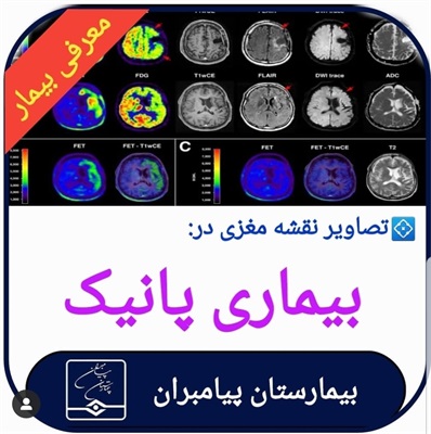 🔴 نقشه مغزی در پانیک!