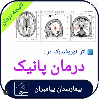 🔴 درمان پانیک ۲