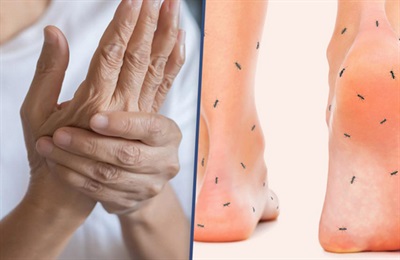 آیا گزگز دست و پا نشانه ام اس است؟