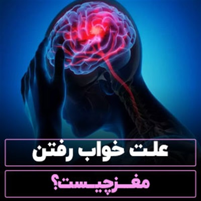 علت خواب رفتن مغز چیست؟【6 علت مهم】+راهکارهای درمانی