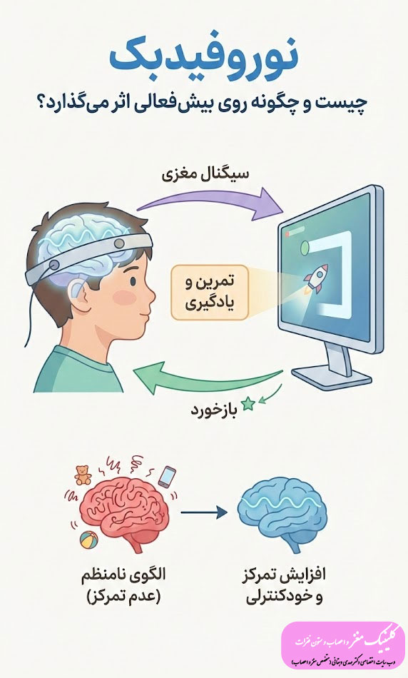 نوروفیدبک چیست و چگونه روی بیشفعالی تاثیر میگذارد؟ نوروفیدبک چیست و چگونه روی بیشفعالی تاثیر میگذارد؟